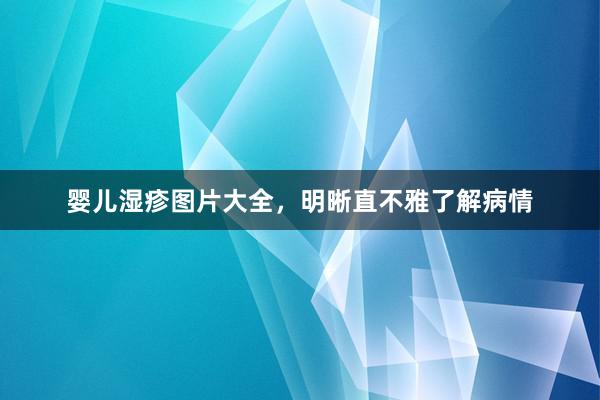 婴儿湿疹图片大全，明晰直不雅了解病情